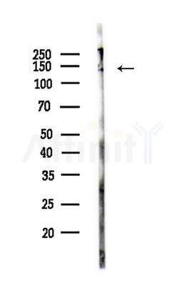 NACAD Antibody - Western blot analysis of lysates from Rat brain, using NACAD Antibody at 1/1000 dilution.