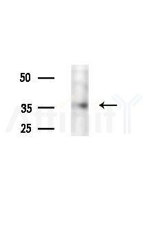 NDUFA9 Antibody - Western blot analysis of lysates from B16F10-LUC cells(LPS,4h treatment), using NDUFA9 Antibody at 1/1000 dilution.