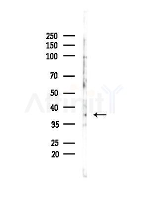 NDUFA9 Antibody - Western blot analysis of lysates from B16F10-LUC cells(LPS,4h treatment), using NDUFA9 Antibody at 1/1000 dilution.