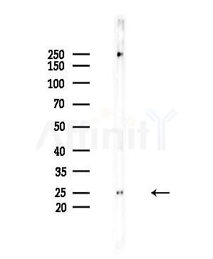 NDUFB10 Antibody - Western blot analysis of lysates from HepG2 cells(UV,30min treatment), using NDUFB10 Antibody at 1/1000 dilution.