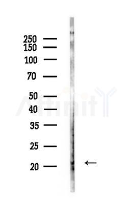 NDUFB9 Antibody - Western blot analysis of lysates from Rat brain, using NDUFB9 Antibody at 1/1000 dilution.