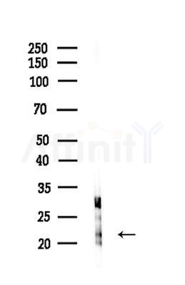 NDUFB9 Antibody - Western blot analysis of lysates from HepG2 cells(LPS 4h treatment), using NDUFB9 Antibody at 1/1000 dilution.