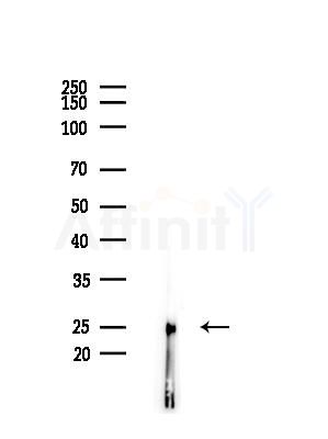 NDUFV2 Antibody - Western blot analysis of lysates from COLO205 cells(heat-shock,45min treatment), using NDUFV2 Antibody at 1/1000 dilution.