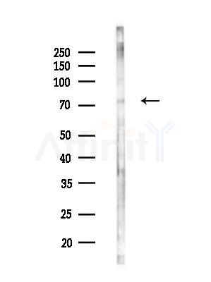 NDUFS1 Antibody - Western blot analysis of lysates from EC304 cells(heat-shock treatment), using NDUFS1 Antibody at 1/1000 dilution.