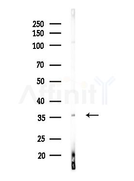 PTGR1 Antibody - Western blot analysis of lysates from MDA-MB-231 cells(heat-shock,45min treatment), using PTGR1 Antibody at 1/1000 dilution.