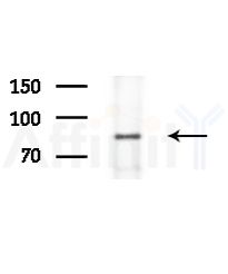 NCAM2 Antibody - Western blot analysis of lysates from HepG2 cells(starvation,24h treatment), using NCAM2 Antibody at 1/1000 dilution.