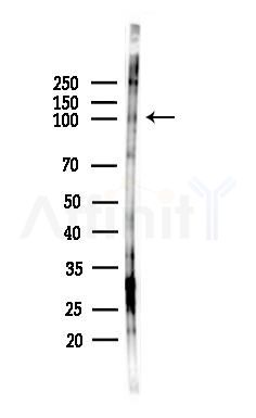 NCAM2 Antibody - Western blot analysis of lysates from HepG2 cells(starvation,24h treatment), using NCAM2 Antibody at 1/1000 dilution.