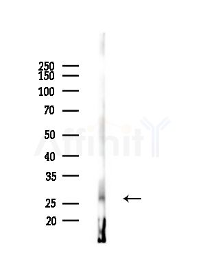 NRL Antibody - Western blot analysis of lysates from A375 cells(starvation,24h treatment), using NRL Antibody at 1/1000 dilution.