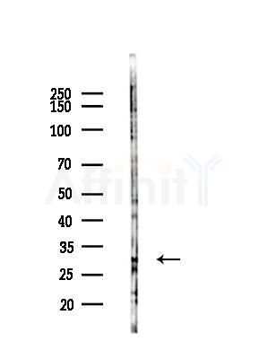 NXPH1 Antibody - Western blot analysis of lysates from COLO205 cells(UV,30min treatment), using NXPH1 Antibody at 1/1000 dilution.