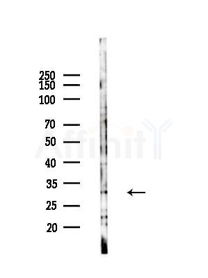 NXPH1 Antibody - Western blot analysis of lysates from LoVo cells(heat-shock,45min treatment), using NXPH1 Antibody at 1/1000 dilution.