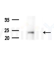 NXPH3 Antibody - Western blot analysis of extracts from Mouse brain, using NXPH3 Antibody at 1/1000 dilution.