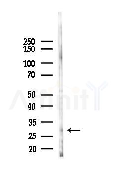 NXPH3 Antibody - Western blot analysis of lysates from Mouse brain, using NXPH3 Antibody at 1/1000 dilution.