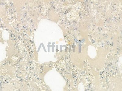 NXPH4 Antibody - DF4232 at 1/100 staining human normal lung tissue by IHC-P.
