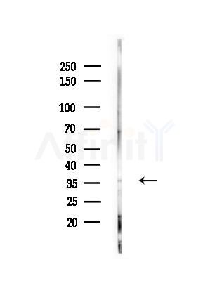 NBPF1/9/10/12/14/15/16/20 Antibody - Western blot analysis of lysates from RAW264.