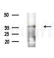 NBPF5 Antibody - Western blot analysis of extracts from HepG2 cells(LPS 4h treatment), using NBPF5 Antibody at 1/1000 dilution.