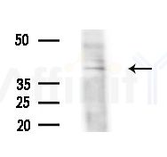 NBPF5 Antibody - Western blot analysis of extracts from Rat brain, using NBPF5 Antibody at 1/1000 dilution.