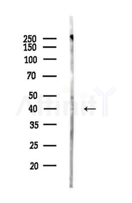 NBPF5 Antibody - Western blot analysis of lysates from Rat brain, using NBPF5 Antibody at 1/1000 dilution.