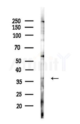 NBPF5 Antibody - Western blot analysis of lysates from HepG2 cells(LPS 4h treatment), using NBPF5 Antibody at 1/1000 dilution.