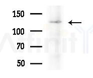 NCAN Antibody - Western blot analysis of extracts from HepG2 cells
(heat-shock treatment), using NCAN Antibody at 1/1000 dilution.