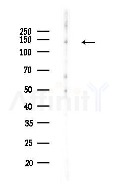 NCAN Antibody - Western blot analysis of lysates from HepG2 cells(heat-shock,45min treatment), using NCAN Antibody at 1/1000 dilution.