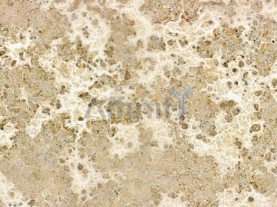 NEGR1 Antibody - DF4240 at 1/100 staining human normal lung tissue by IHC-P.