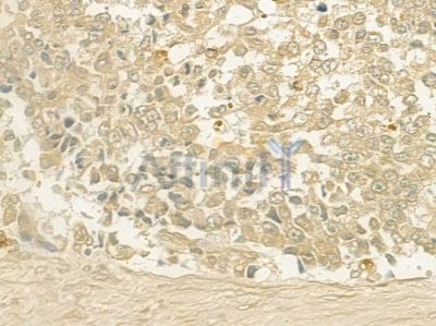 NEGR1 Antibody - DF4240 at 1/100 staining human normal gastric tissue by IHC-P.