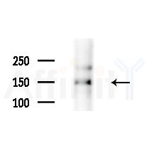 PNPLA6 Antibody - Western blot analysis of lysates from HepG2 cells(starvation,24h treatment), using PNPLA6 Antibody at 1/1000 dilution.