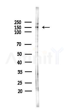 PNPLA6 Antibody - Western blot analysis of lysates from HepG2 cells(starvation,24h treatment), using PNPLA6 Antibody at 1/1000 dilution.