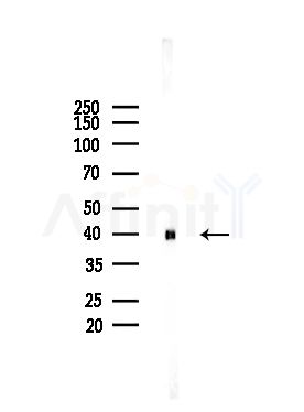 NT Antibody - Western blot analysis of lysates from Rat liver, using NT Antibody at 1/1000 dilution.