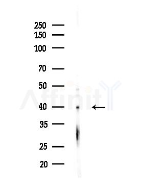 NT Antibody - Western blot analysis of lysates from MDA-MB-231 cells(heat-shock,45min treatment), using NT Antibody at 1/1000 dilution.