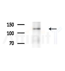 NUP160 Antibody - Western blot analysis of extracts from HepG2 cells(starvation,24h treatment), using NUP160 Antibody at 1/1000 dilution.
