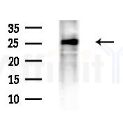 CIP29 Antibody - Western blot analysis of extracts from Hela cells, using CIP29 Antibody at 1/1000 dilution.