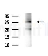 CIP29 Antibody - Western blot analysis of extracts from Mouse liver, using CIP29 Antibody at 1/1000 dilution.