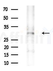 CIP29 Antibody - Western blot analysis of extracts from HepG2 cells(LPS 4h treatment), using CIP29 Antibody at 1/1000 dilution.