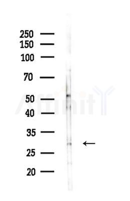 CIP29 Antibody - Western blot analysis of lysates from HepG2 cells(LPS 4h treatment), using CIP29 Antibody at 1/1000 dilution.