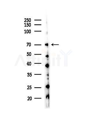 NCOA4 Antibody - Western blot analysis of lysates from Hela cells(heat-shock,45min treatment), using NCOA4 Antibody at 1/1000 dilution.