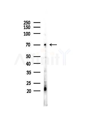 NCOA4 Antibody - Western blot analysis of lysates from COLO205 cells(UV,30min treatment), using NCOA4 Antibody at 1/1000 dilution.