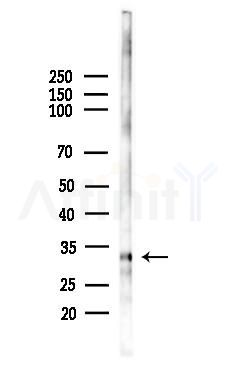 NRBF2 Antibody - Western blot analysis of lysates from HepG2 cells(starvation,24h treatment), using NRBF2 Antibody at 1/1000 dilution.