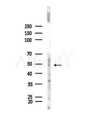 NUSAP1 Antibody - Western blot analysis of lysates from Hela cells(UV,30min treatment), using NUSAP1 Antibody at 1/1000 dilution.
