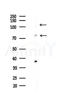 NOLC1 Antibody - Western blot analysis of lysates from B16F10-LUC cells(heat-shock,45min treatment), using NOLC1 Antibody at 1/1000 dilution.