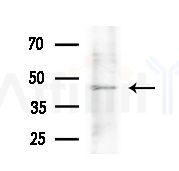 OAT Antibody - Western blot analysis of lysates from HepG2 cells
(heat-shock treatment), using OAT Antibody at 1/1000 dilution.