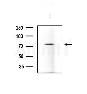 SLC6A15 Antibody - Western blot analysis of extracts from EC304 cells, using SLC6A15 Antibody at 1/1000 dilution.