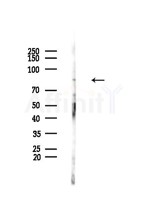 SLC6A15 Antibody - Western blot analysis of lysates from EC304 cells, using SLC6A15 Antibody at 1/1000 dilution.