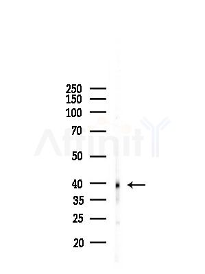 ZDHHC15 Antibody - Western blot analysis of lysates from RAW264.