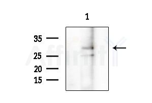 ZDHHC7 Antibody - Western blot analysis of extracts from COLO205 cells, using ZDHHC7 Antibody at 1/1000 dilution.