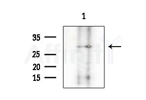 ZDHHC7 Antibody - Western blot analysis of extracts from EC304 cells, using ZDHHC7 Antibody at 1/1000 dilution.