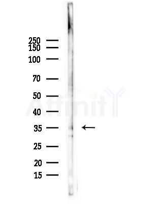 ZDHHC7 Antibody - Western blot analysis of lysates from EC304 cells, using ZDHHC7 Antibody at 1/1000 dilution.