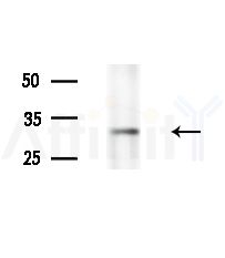 DECR2 Antibody - Western blot analysis of extracts from HepG2 cells(starvation,24h treatment), using DECR2 Antibody at 1/1000 dilution.