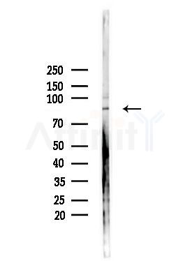 EHHADH Antibody - Western blot analysis of lysates from PC12 cells(heat-shock,45min treatment), using EHHADH Antibody at 1/1000 dilution.