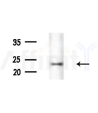 PEX11B Antibody - Western blot analysis of extracts from HepG2 cells(starvation,24h treatment), using PEX11B Antibody at 1/1000 dilution.
